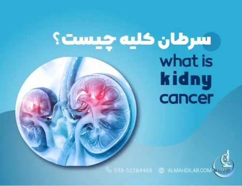سرطان کلیه : علائم، علل، تشخیص، پیشگیری و درمان