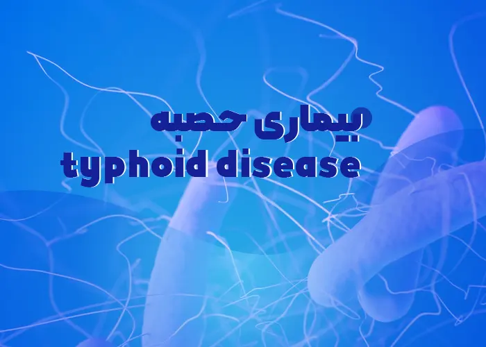 بیماری حصبه یا تب تیفوئید + علائم، علل، تشخیص، پیشگیری و درمان