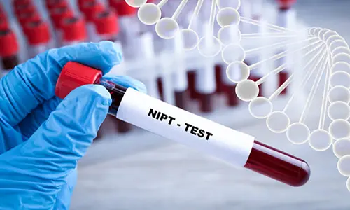 شرایط نمونه گیری آزمایش باداری NIPT