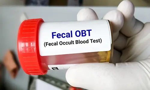 شرایط نمونه گیری آزمایش خون مخفی در مدفوع OB