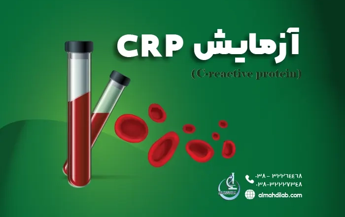 آزمایش CRP چیست؟ تفسیر CRP در تست خون