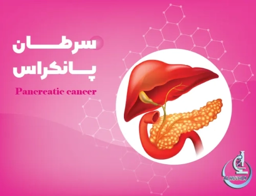 سرطان پانکراس: علائم، پیشگیری، تشخیص و درمان