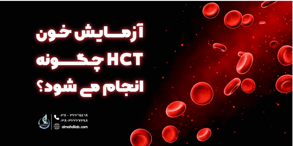 آزمایش خون HCT چگونه انجام می شود؟