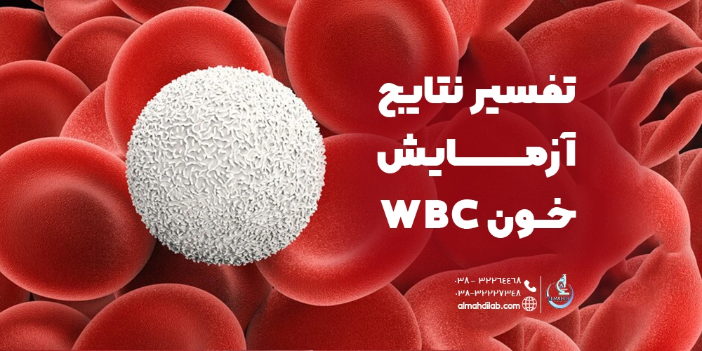 تفسیر نتایج آزمایش خون WBC