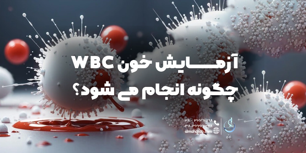 آزمایش خون WBC چگونه انجام می شود؟