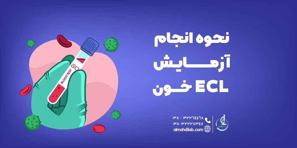 نحوه انجام آزمایش ECL خون